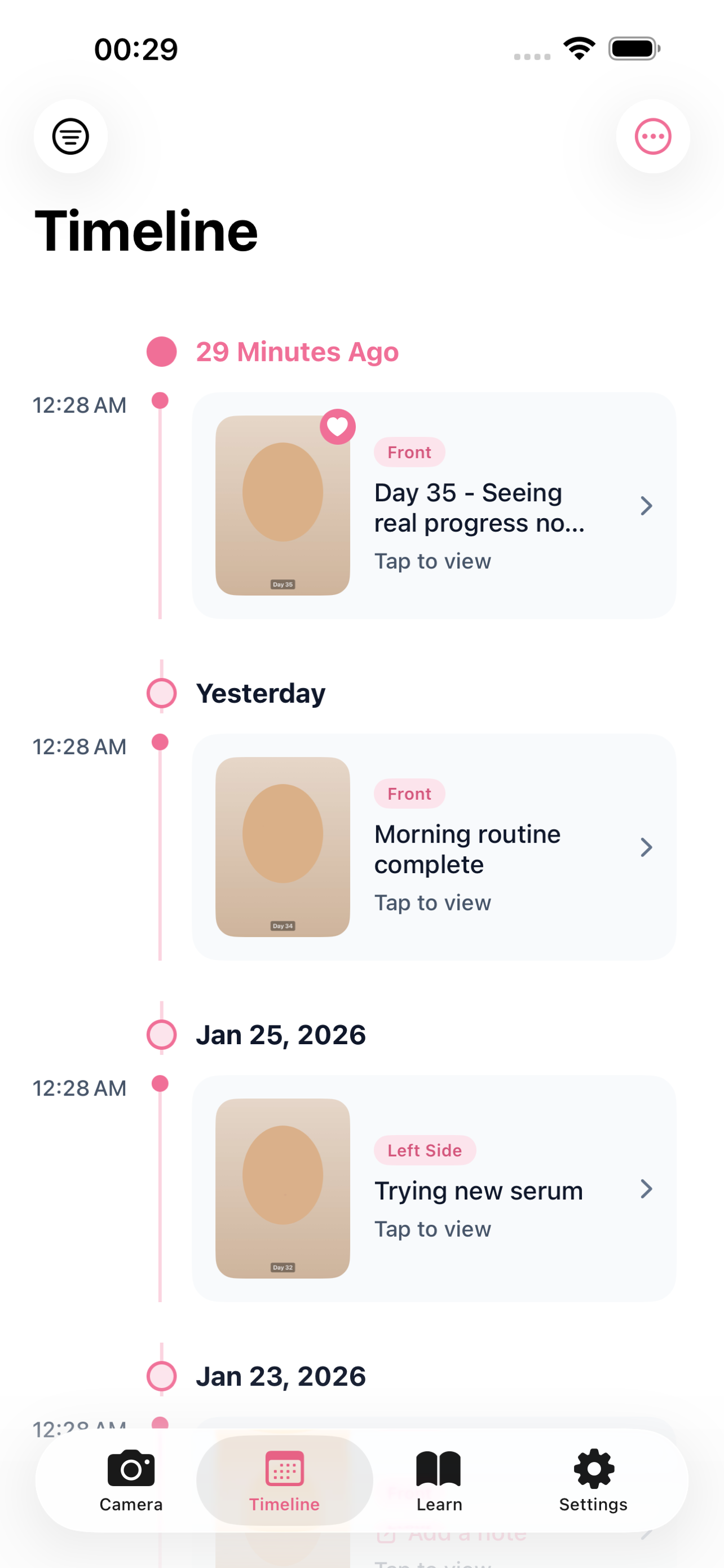 Timeline view